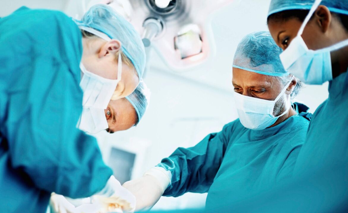 Het proces van penisvergroting door chirurgen door middel van een operatie